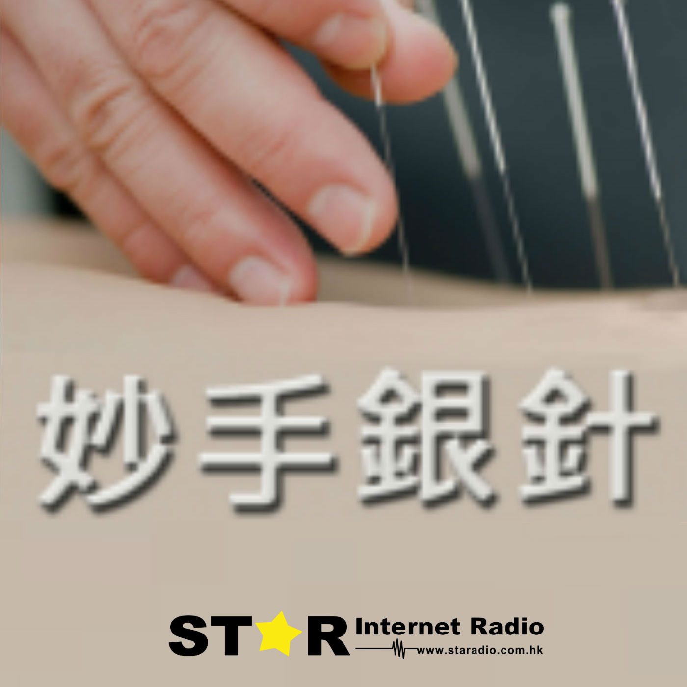 星滙網 Star Internet Radio妙手銀針 – 星滙網 Star Internet Radio